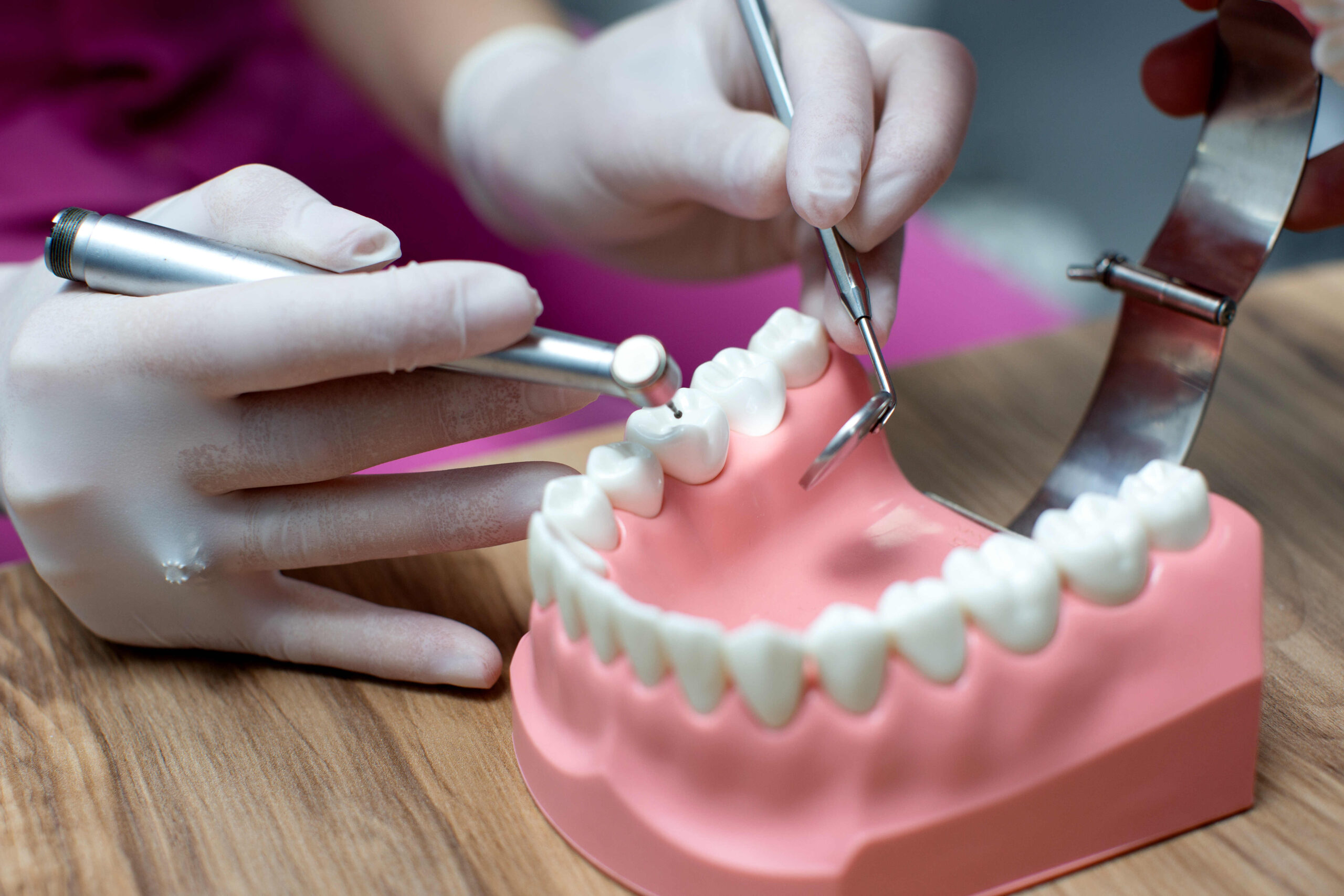 Prótese dentária: quando ela é indicada e como devolve função e autoestima