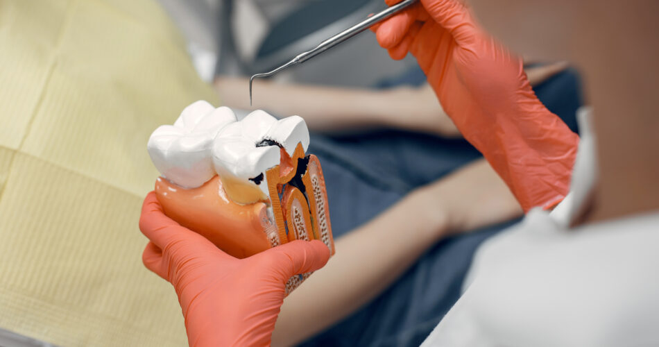 o que é endodontia
