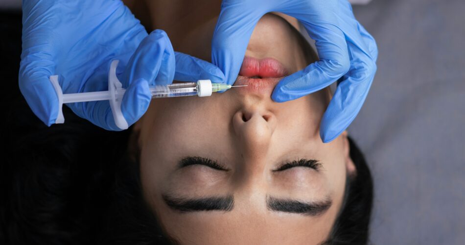 harmonização facial