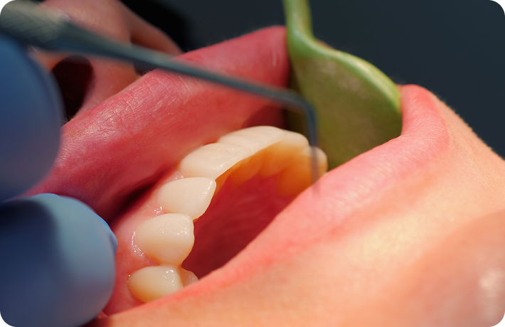 Periodontia