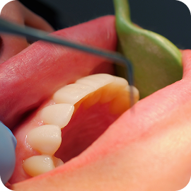 Periodontia