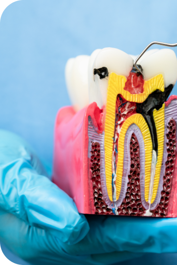 Endodontia